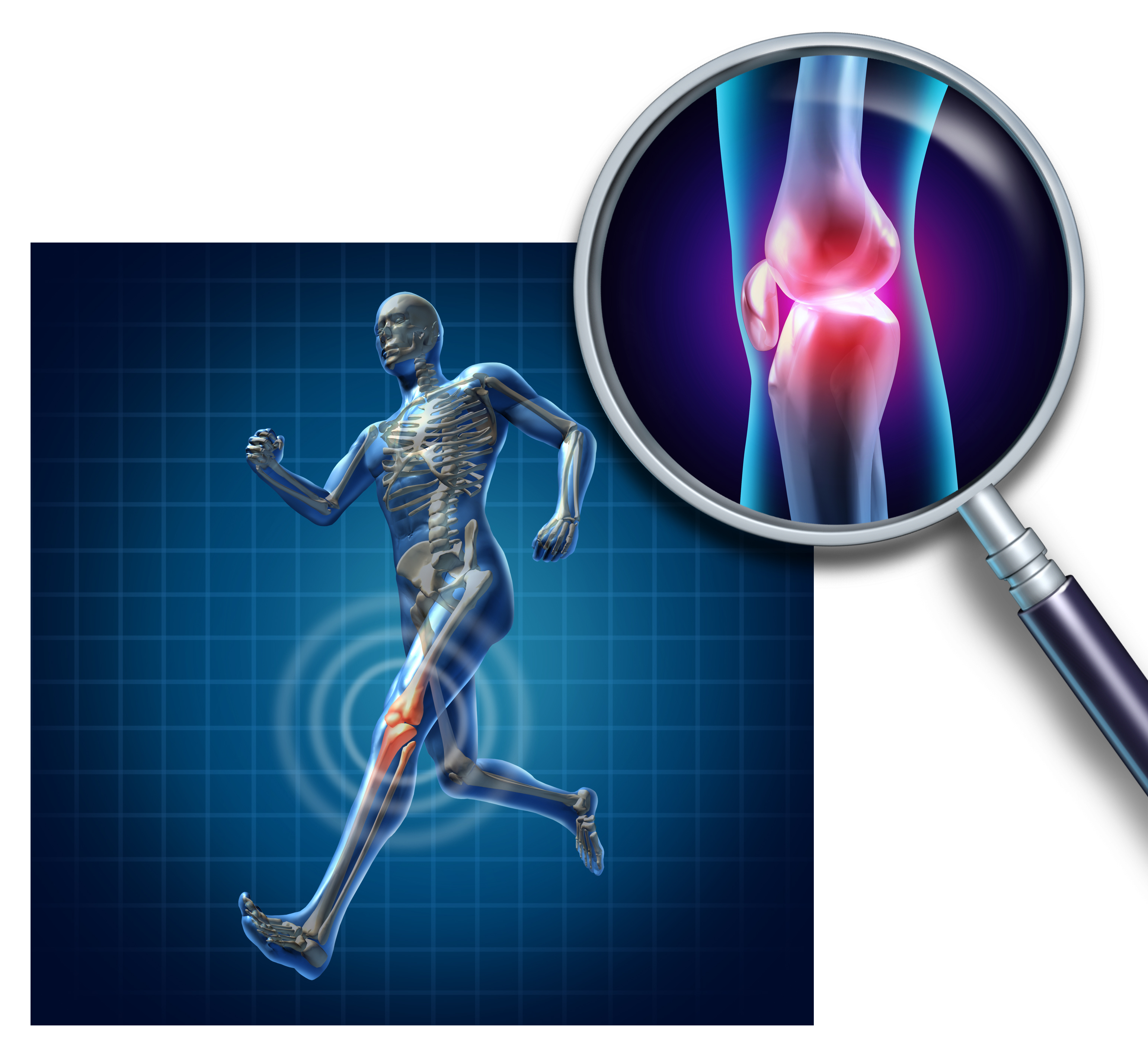 Praxis für Orthopädie und Unfallchirugie Sportverletzungen und Überlastungsschäden