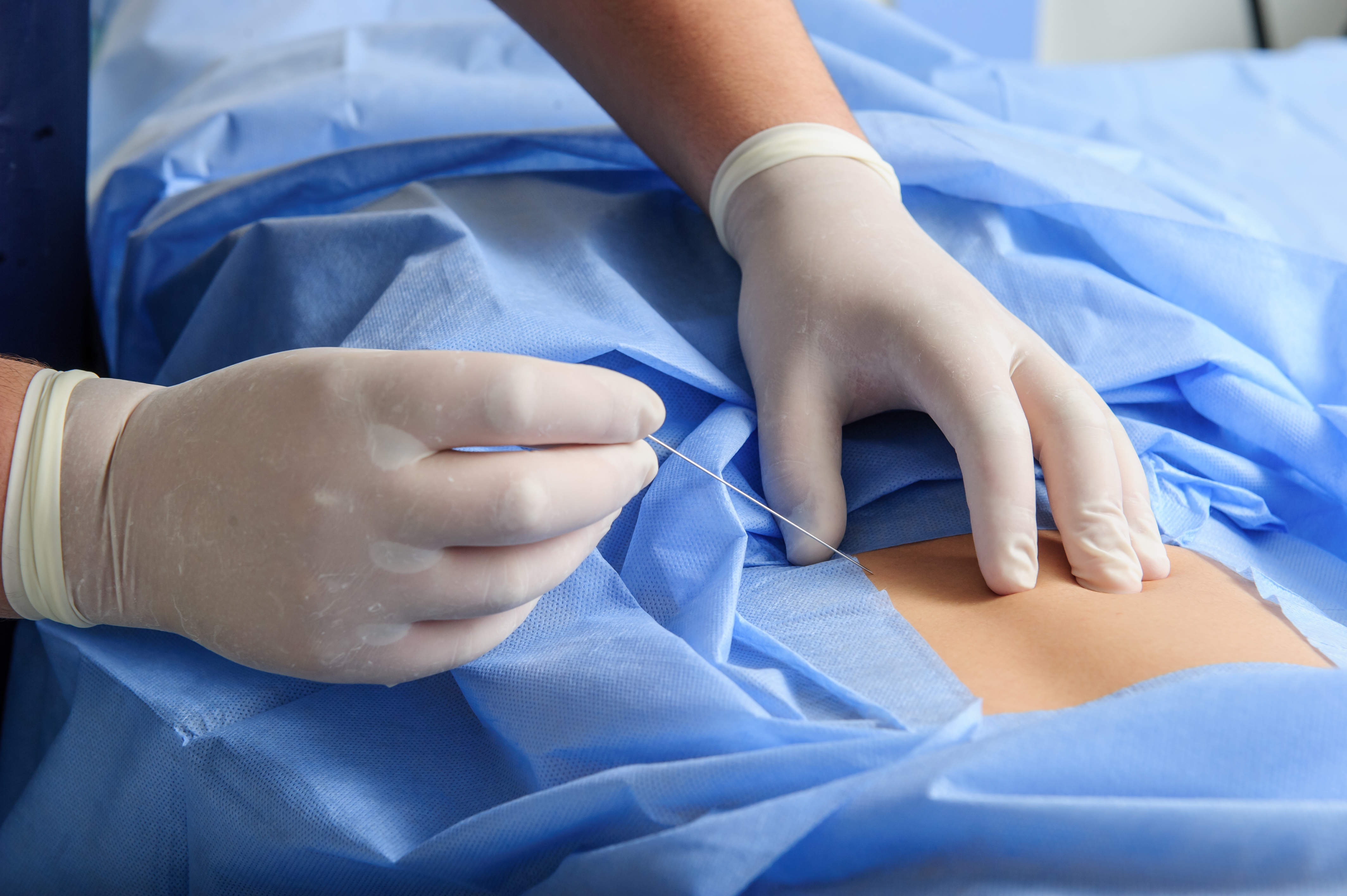 Praxis für Orthopädie und Unfallchirugie Bildwandlergestützte Injektionstherapie an der Wirbelsäule