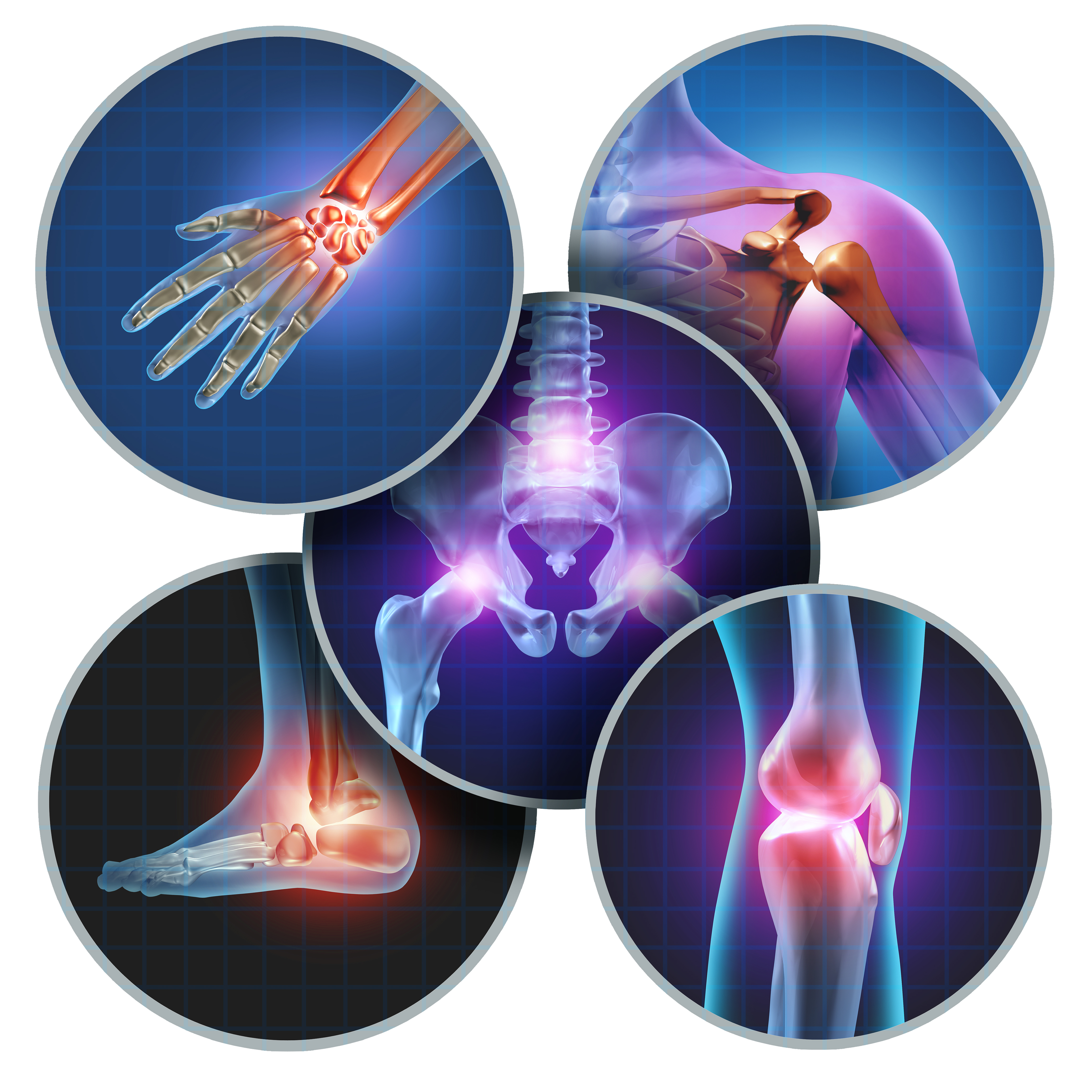 Praxis für Orthopädie und Unfallchirugie Konservative Arthrosetherapie großer und kleiner Gelenke
